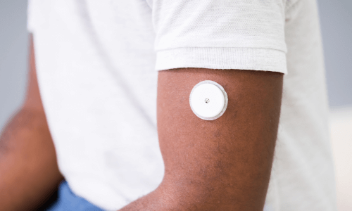 Close-up of adult male in a white T-shirt wearing a CGM on his upper arm