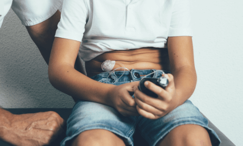 Close-up of boy wearing infusion set on his midsection & holding insulin pump