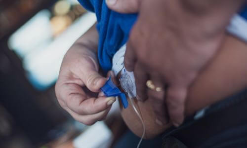 Close-up of adult attaching insulin pump cannula to the abdomen