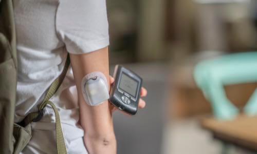 Close-up of young woman wearing Omnipod tubeless insulin pod & checking the Personal Diabetes Manager