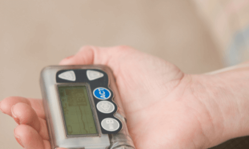 Close-up of a hand holding an insulin pump